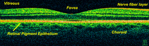 OCT scan of a retina at 800nm with an axial re...