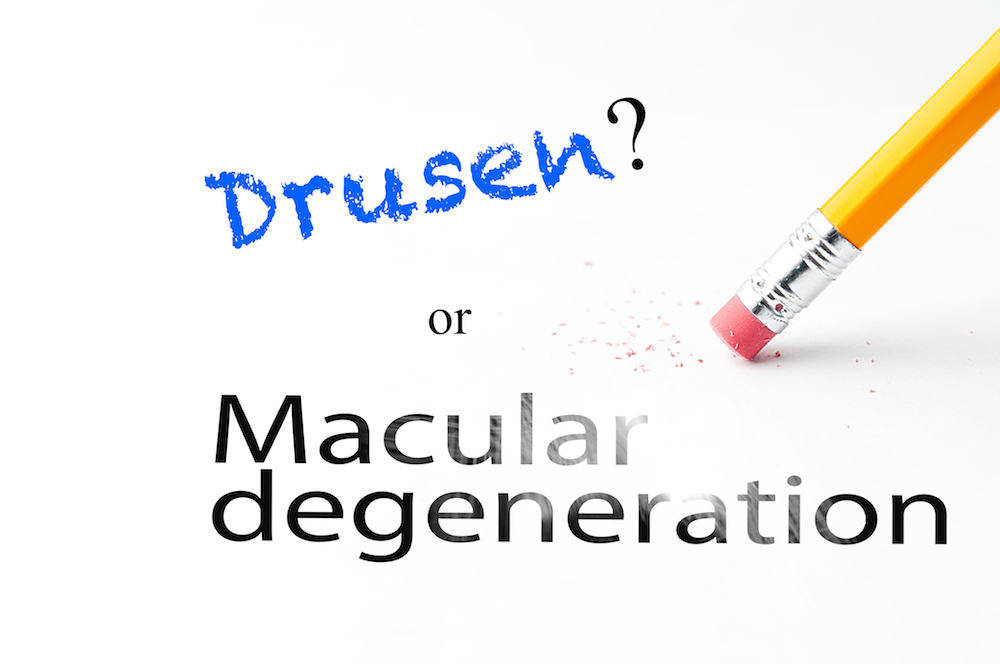 Drusen and Macular Degeneration