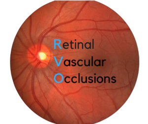 Retinal Vascular Occlusions | BRVO, CRVO, CRAO, BRAO