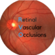 Retinal Vascular Occlusions | BRVO, CRVO, CRAO, BRAO