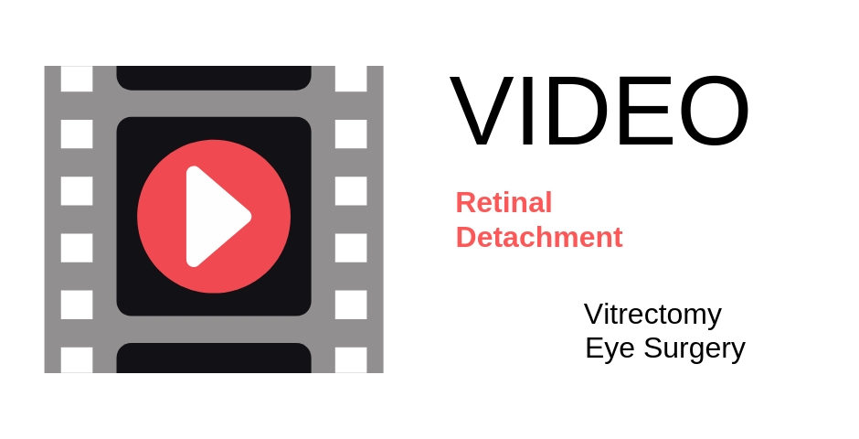 Retina Specialist | Retinal Detachment | Northern Virginia | Washington DC